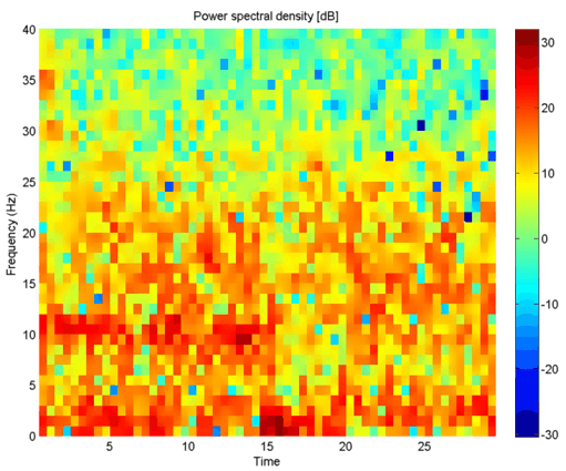 Matlab EEG
                                    Spectrogramexample